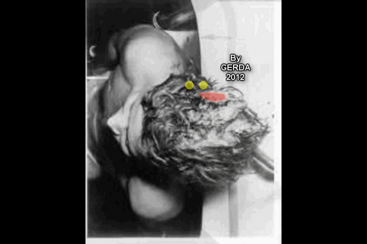 Gerda_Dunckel_Gif_1.gif
